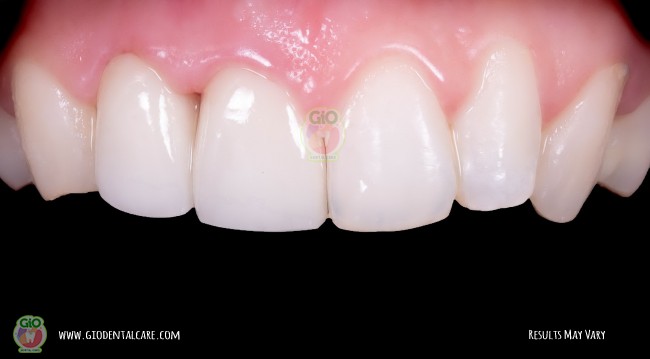 get-your-smile-here--1